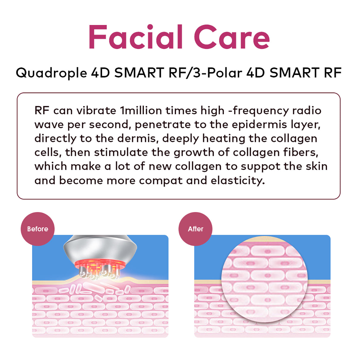 SQ90E Plus เครื่องคาวิเทชันอัลตราโซนิก 80K และ RF แบบ 9-in-1 พร้อมแผ่นเลเซอร์ + ไมโครเคอร์เรนต์